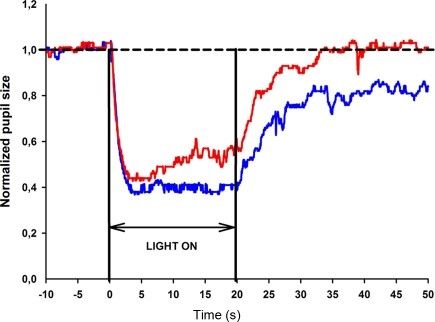Comparison of pupil size during and after exposure to different wavelengths of light